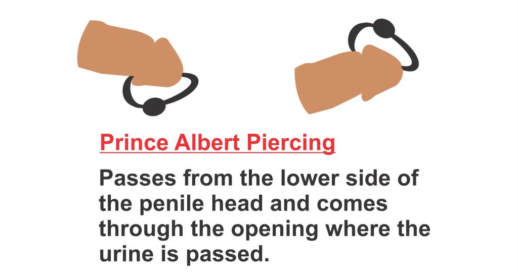 Prince Albert piercing Passes from 
the lower side of the penile head and 
comes through the opening where the 
urine is passed.